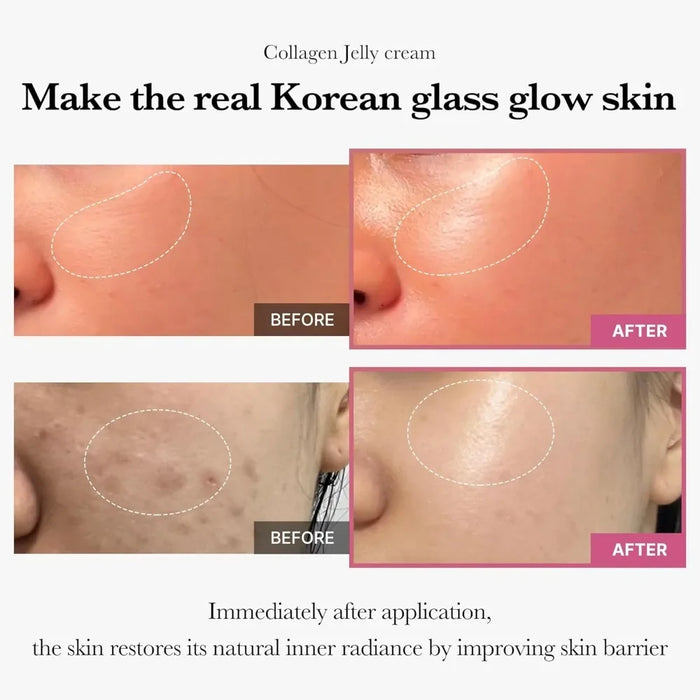 Collagen Jelly Cream with Niacinamide & Hydrolyzed Collagen