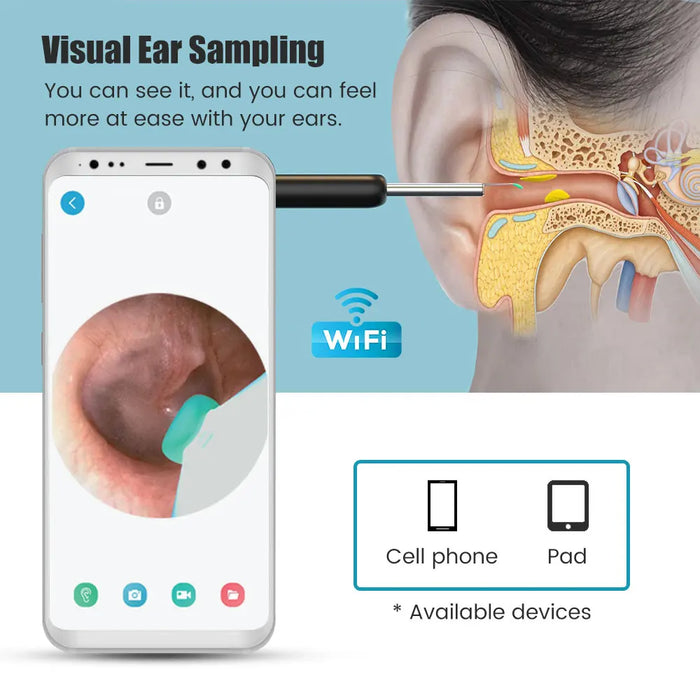 Smart Visual Earwax Cleaner – Wireless Otoscope with HD Camera, Ear Pick Removal Tool Kit