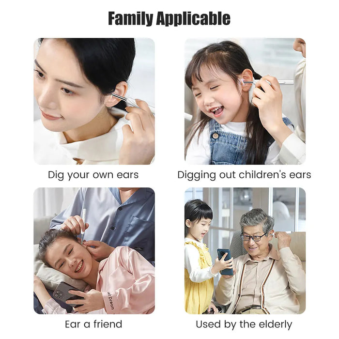 Smart Visual Earwax Cleaner – Wireless Otoscope with HD Camera, Ear Pick Removal Tool Kit